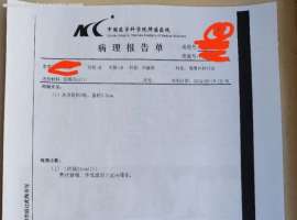 38岁，喜提管状腺瘤一枚