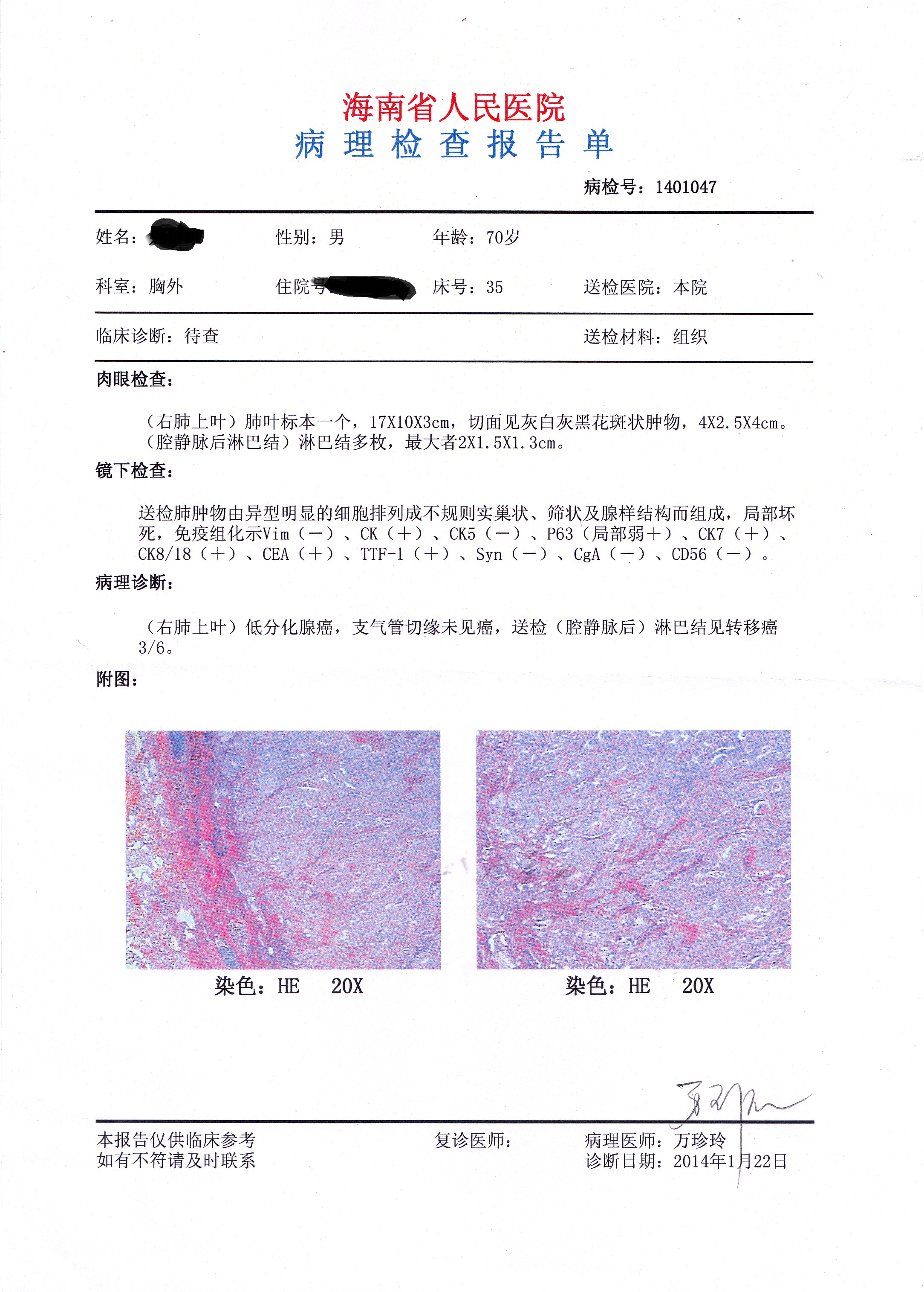 病理报告