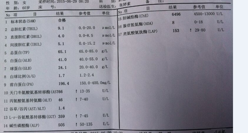 2015.6.29号肝功能检查