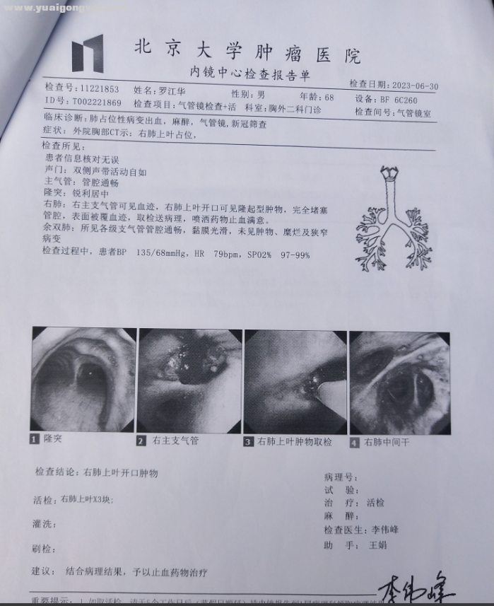 气管镜检查 活 7.1.png